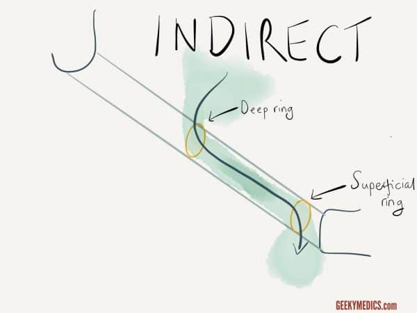 Untitled 1 11.png|Untitled 1 11.png