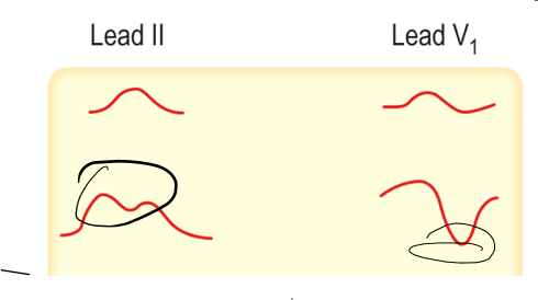 Untitled 1 15.png|Untitled 1 15.png