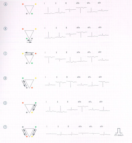 Untitled 10 6.png|Untitled 10 6.png