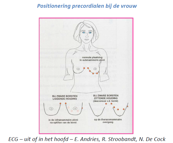 Untitled 11 5.png|Untitled 11 5.png