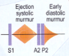 Untitled 2 11.png|Untitled 2 11.png