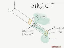 Untitled 47.png|Untitled 47.png