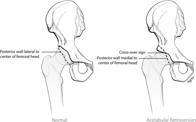 Untitled 57.png|Untitled 57.png