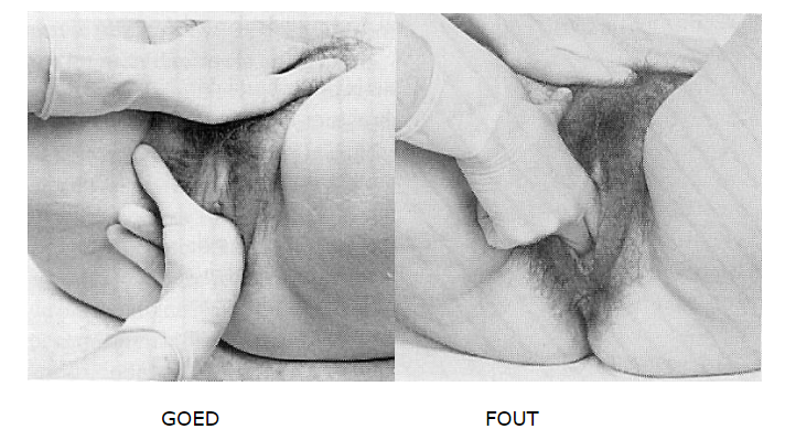 Untitled 82.png|Untitled 82.png